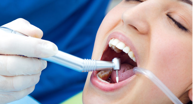 Root Canal Tretment in Panvel at affordable cost in Panvel Vichare Dental Clinic